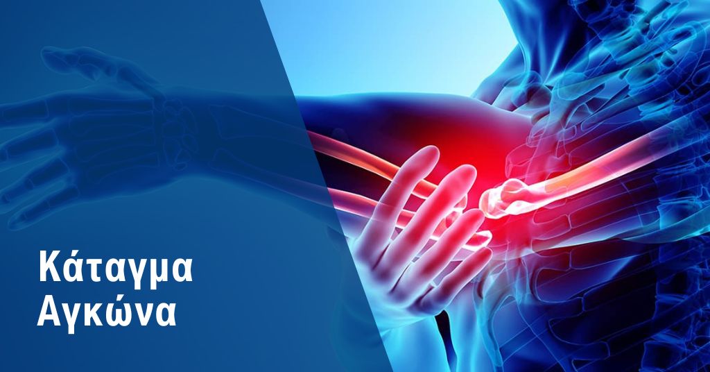 κάταγμα αγκώνα 1