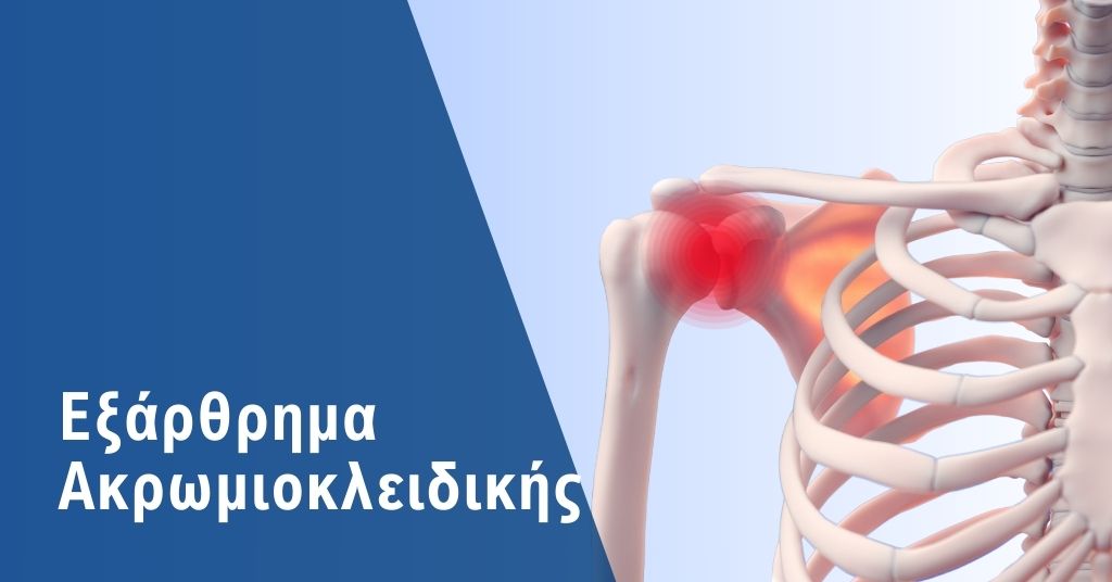 εξάρθρημα ακρωμιοκλειδικής